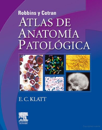 ROBBINS y COTRAN. Atlas de anatomía patológica