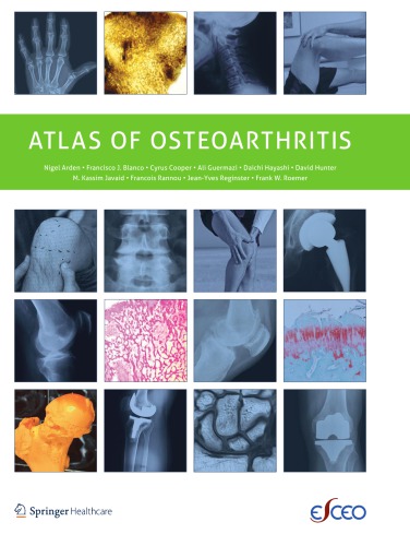 Atlas of osteoarthritis