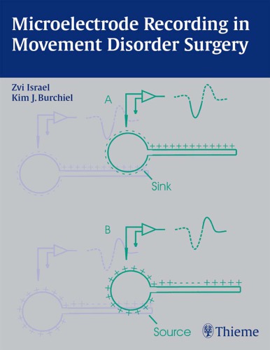 Microelectrode recording in movement disorder surgery