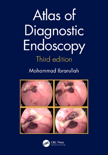Atlas of diagnostic endoscopy
