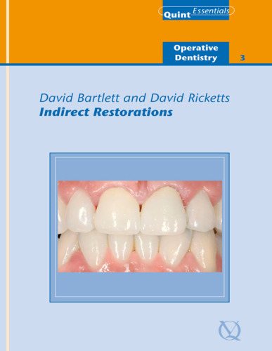 Indirect Restorations: Quintessentials of Dental Practice Vol. 25