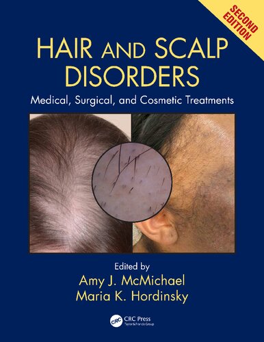 Hair and scalp disorders : medical, surgical, and cosmetic treatments