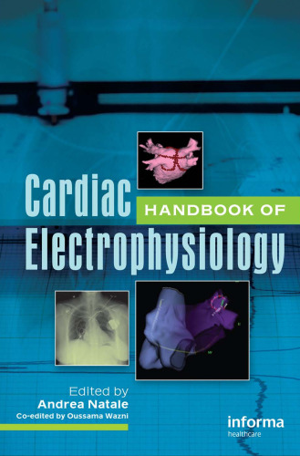 Handbook of Cardiac Electrophysiology