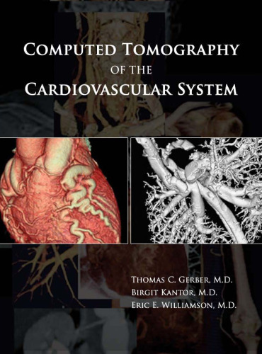 Computed Tomography of the Cardiovascular System