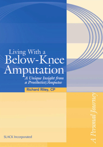 Living with a Below-Knee Amputation: A Unique Insight from a Prosthetist/Amputee