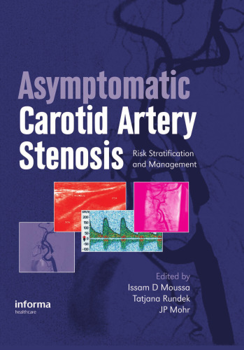 Asymptomatic Carotid Artery Stenosis: A Primer on Risk Stratification and Management
