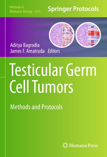 Testicular Germ Cell Tumors: Methods and Protocols