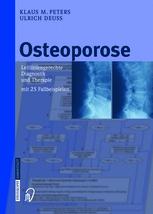 Osteoporose: Leitliniengerechte Diagnostik und Therapie