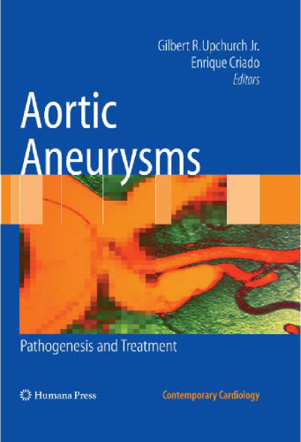 Aortic Aneurysms: Pathogenesis and Treatment