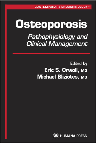Osteoporosis: Pathophysiology and Clinical Management