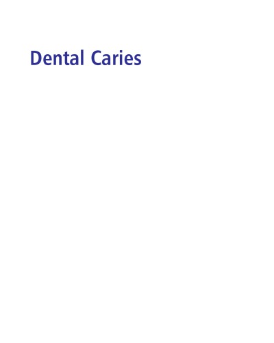 Dental Caries: the Disease and Its Clinical Management