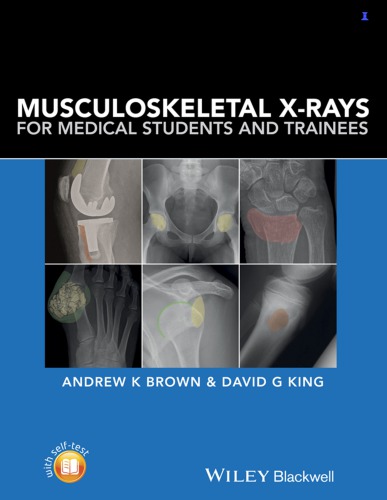 Musculoskeletal X-rays for medical students and trainees