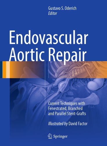 Endovascular Aortic Repair Current Techniques with Fenestrated, Branched and Parallel Stent-Grafts