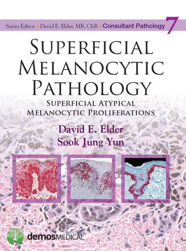 Superficial Melanocytic Pathology