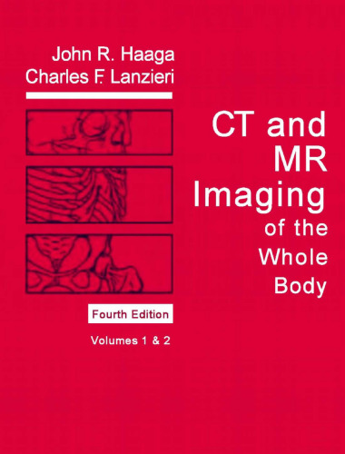 CT and MR Imaging of the Whole Body