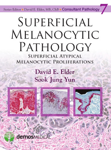 Superficial melanocytic pathology: superficial atypical melanocytic proliferations