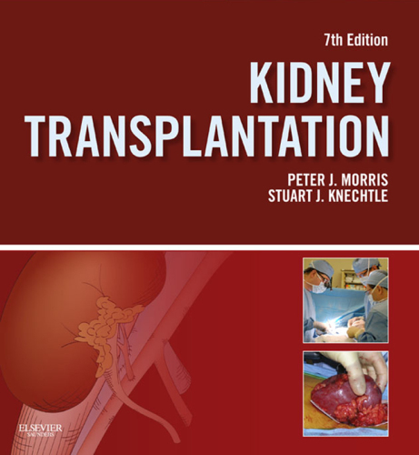 Kidney transplantation: principles and practice