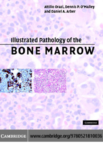 Illustrated Pathology of the Bone Marrow