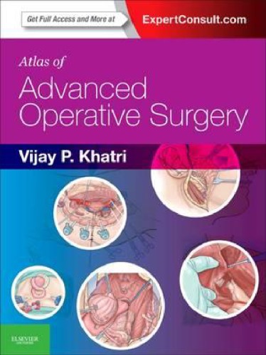 Atlas of advanced operative surgery