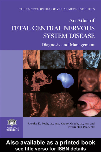 An Atlas of Fetal Central Nervous System Disease: Diagnosis and Management