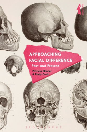 Approaching facial difference: past and present
