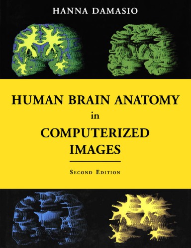 Human brain anatomy in computerized images