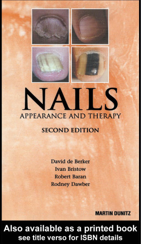 Nails: Pocketbook: Appearance and Therapy