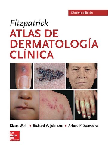 Atlas de dermatología clínica