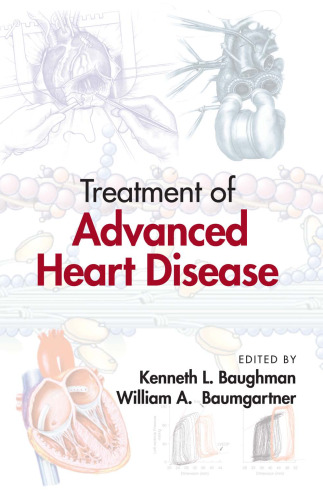 Treatment of Advanced Heart Disease