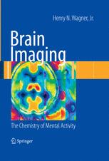 Brain Imaging: The Chemistry of Mental Activity