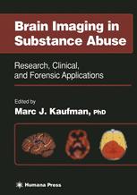 Brain Imaging in Substance Abuse: Research, Clinical, and Forensic Applications
