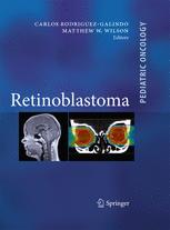 Retinoblastoma