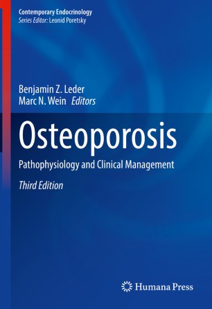 Osteoporosis: Pathophysiology and Clinical Management
