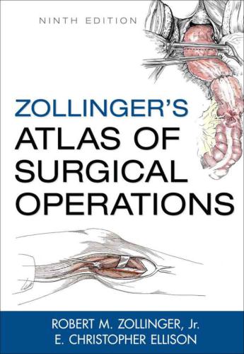 Zollinger's Atlas of Surgical Operations