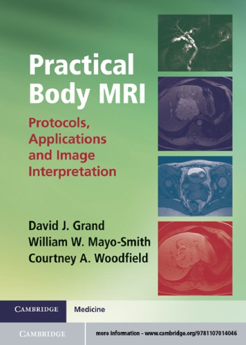 Practical body MRI: protocols, applications, and image interpretation
