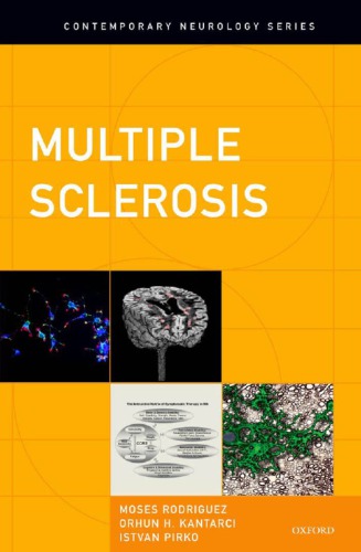 Multiple sclerosis