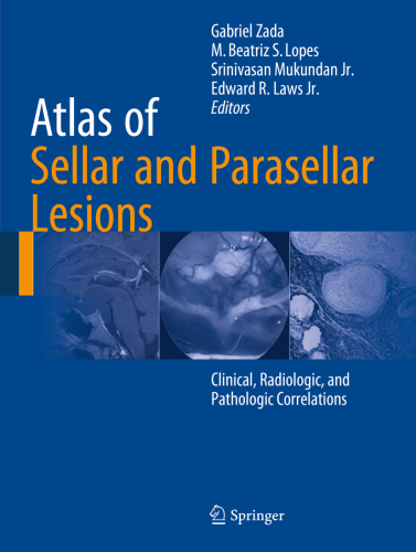 Atlas of Sellar and Parasellar Lesions Clinical, Radiologic, and Pathologic Correlations