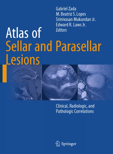 Atlas of sellar and parasellar lesions: clinical, radiologic, and pathologic correlations