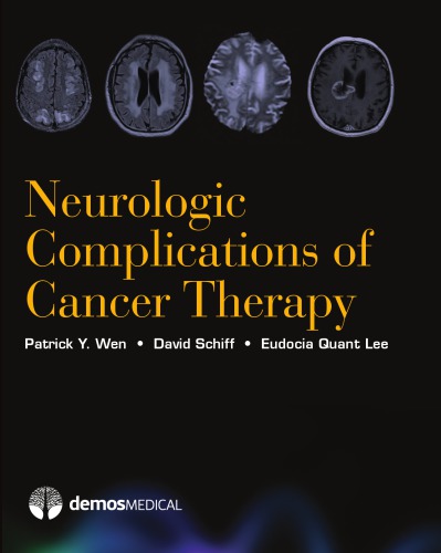 Neurologic complications of cancer therapy