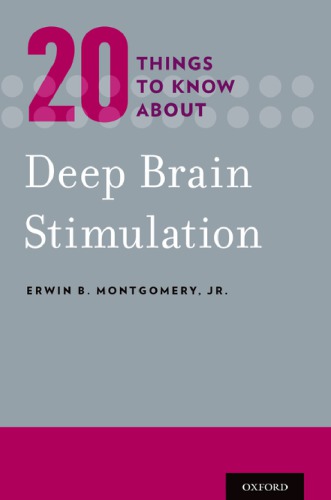 20 things to know about deep brain stimulation