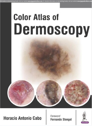 Colour Atlas of Dermoscopy