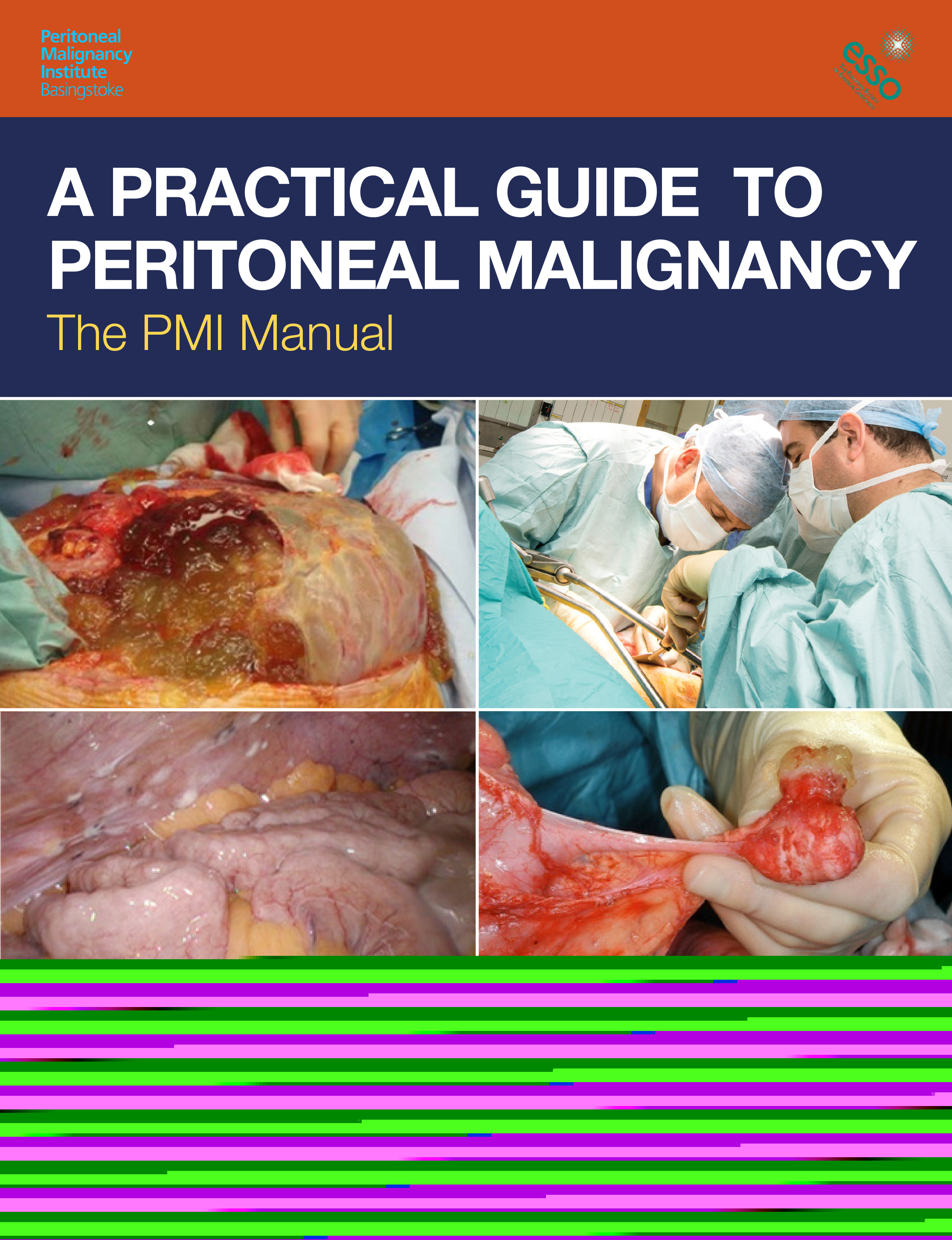 A Practical Guide to Peritoneal Malignancy-The PMI Manual