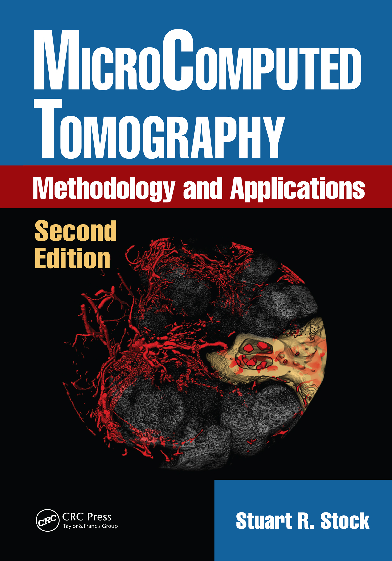 MicroComputed Tomography-Methodology and Applications, Second Edition