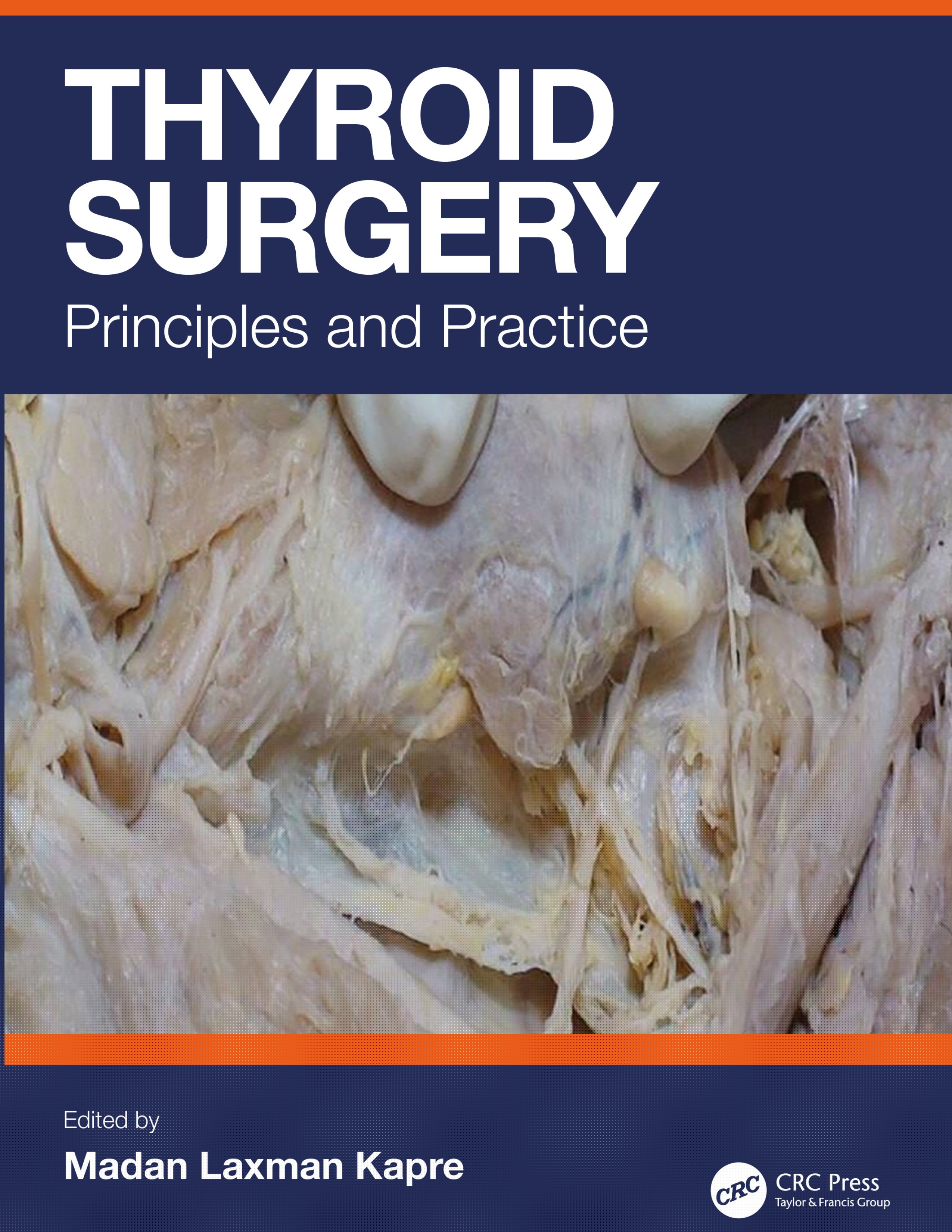 Thyroid Surgery-Principles and Practice