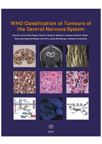 WHO Classification of Tumours of the Central Nervous System