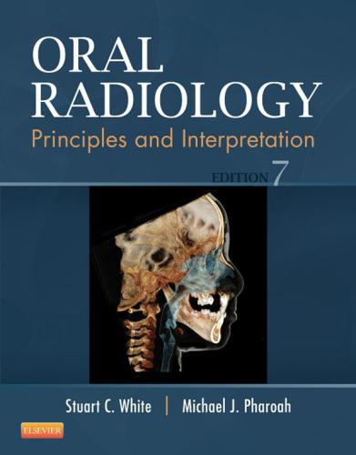 Oral radiology: principles and interpretation