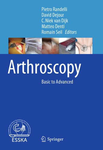 Arthroscopy basic to advanced