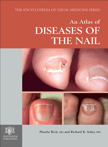 An atlas of diseases of the nail