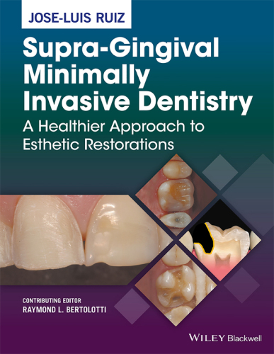 Supra-gingival minimally invasive dentistry a healthier approach to esthetic restorations