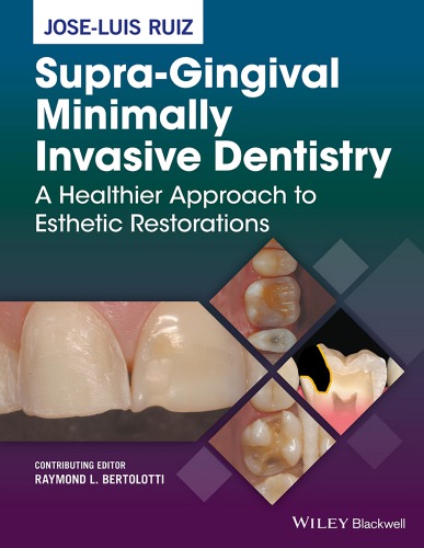 Supra-gingival minimally invasive dentistry a healthier approach to esthetic restorations